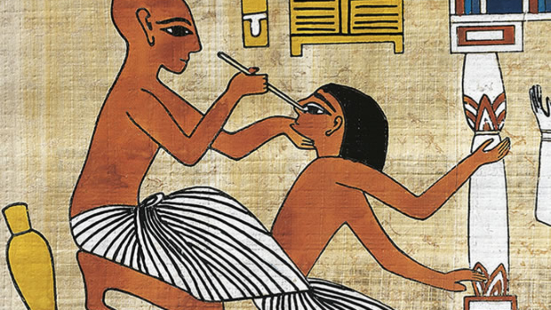 Cataract-in-Ancient-Egypt-3
