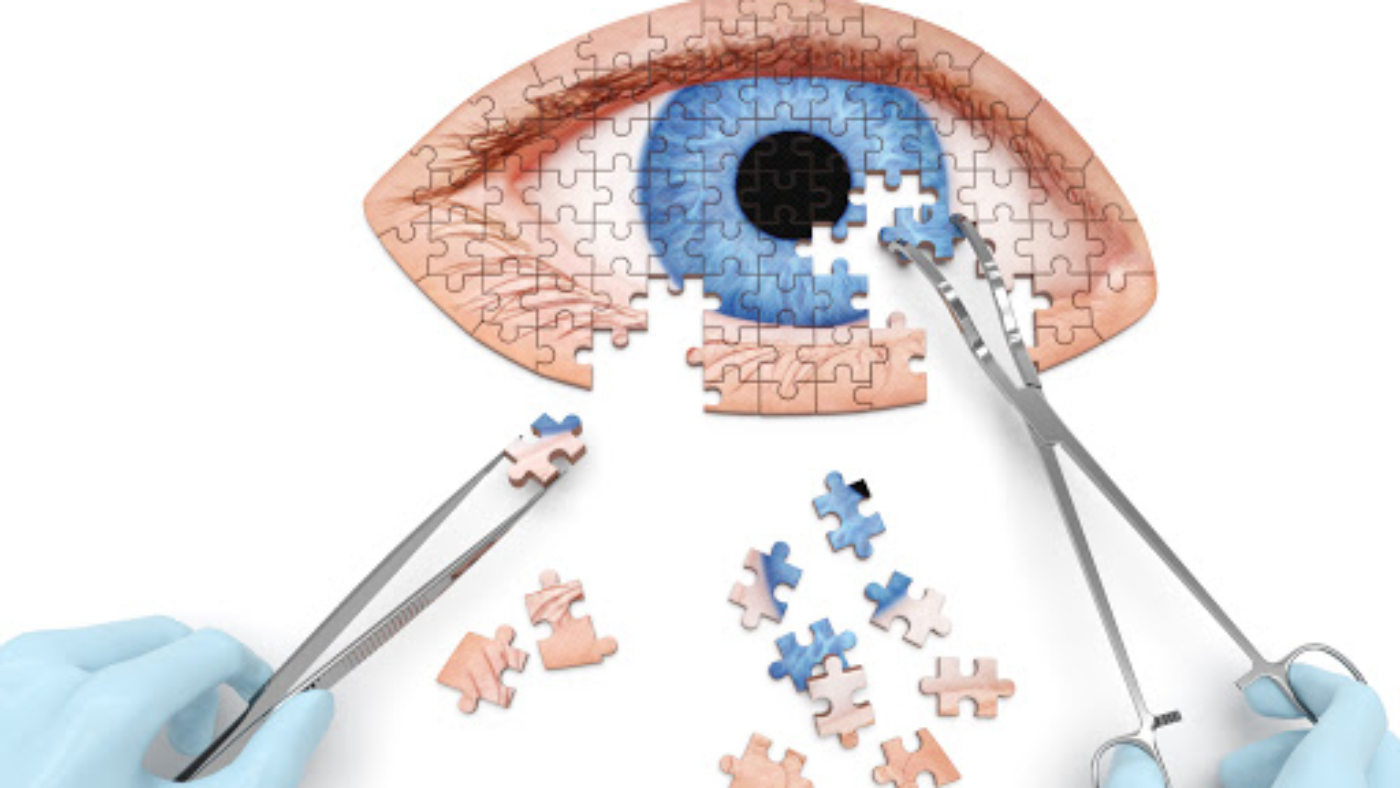 34698123 - eye operation (vision correction) puzzle concept:
