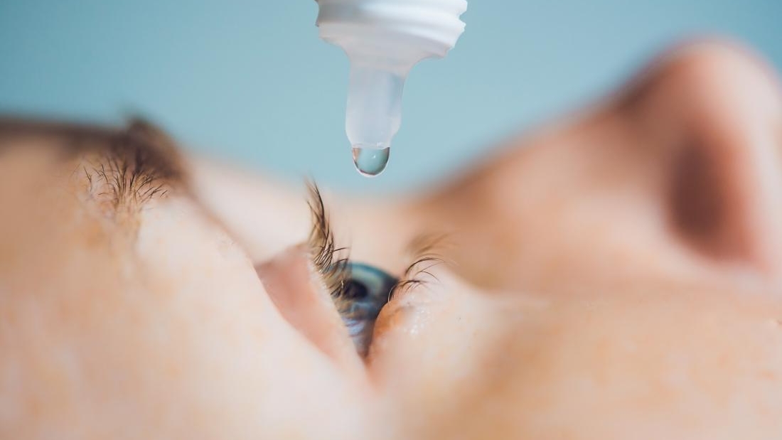 eye-drop-being-squeezed-into-eye