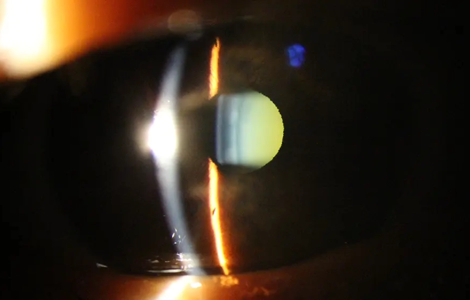 17-01-2023-Anonymous-0-Masculino-R-1 copiar